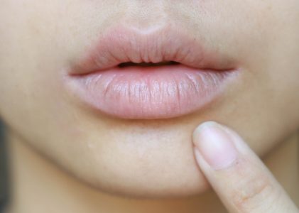 Cara Mengatasi Bibir Kering